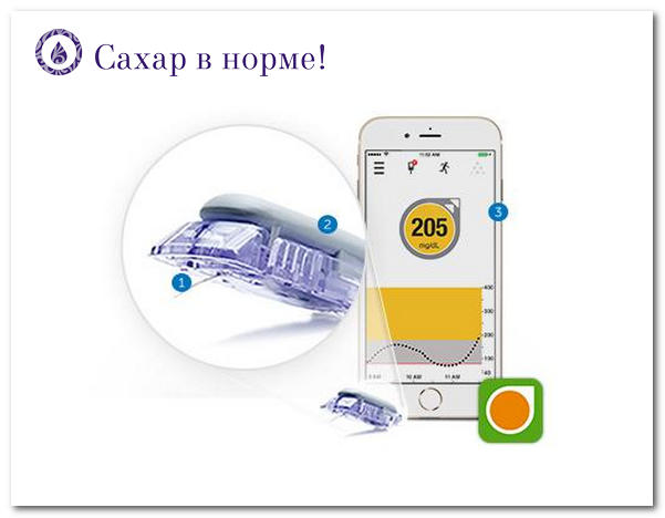 Dexcom G5 Mobile (Декском G5) и I-port Advance в помощь диабетику