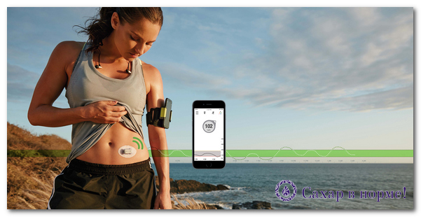 Dexcom G5 Mobile (Декском G5) и I-port Advance в помощь диабетику